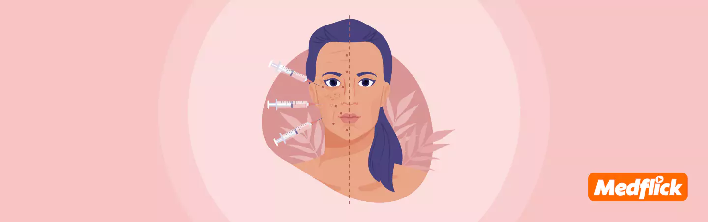 Face Lift - Know Everything Before You Go For Surgery
